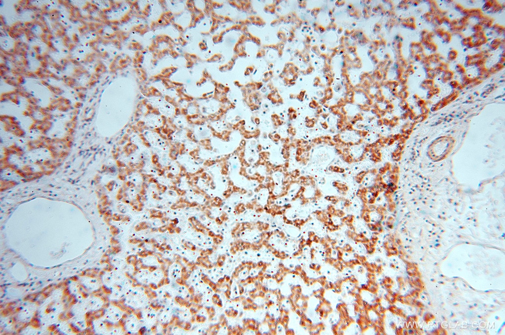 Immunohistochemistry (IHC) staining of human liver tissue using NDUFB10 Polyclonal antibody (15589-1-AP)