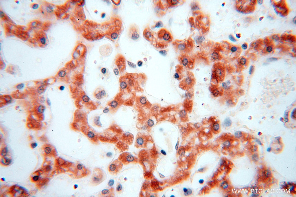 Immunohistochemistry (IHC) staining of human liver tissue using NDUFB10 Polyclonal antibody (15589-1-AP)