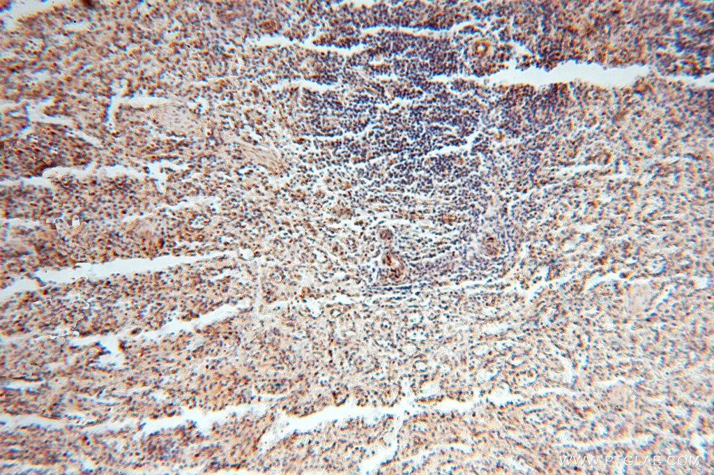 Immunohistochemistry (IHC) staining of human spleen tissue using NDUFB10 Polyclonal antibody (15589-1-AP)