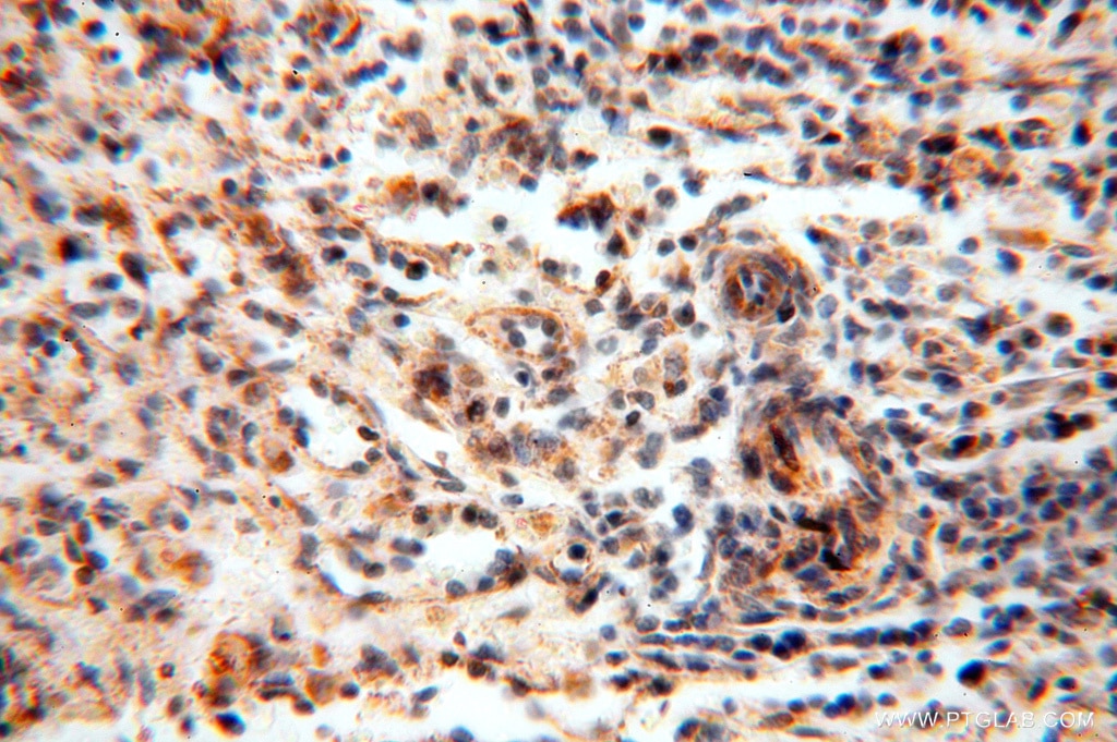 Immunohistochemistry (IHC) staining of human spleen tissue using NDUFB10 Polyclonal antibody (15589-1-AP)