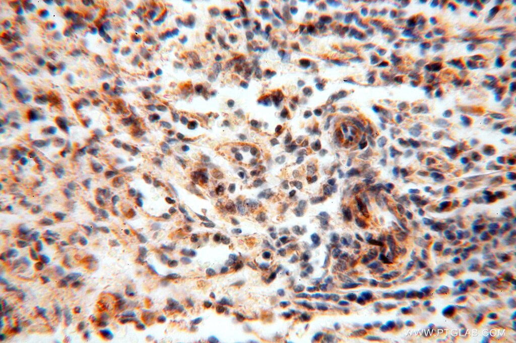 IHC staining of human spleen using 15589-1-AP