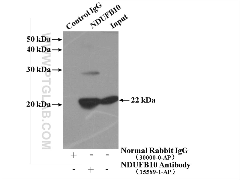Immunoprecipitation (IP) experiment of HepG2 cells using NDUFB10 Polyclonal antibody (15589-1-AP)