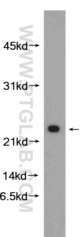 Western Blot (WB) analysis of mouse liver tissue using NDUFB10 Polyclonal antibody (15589-1-AP)