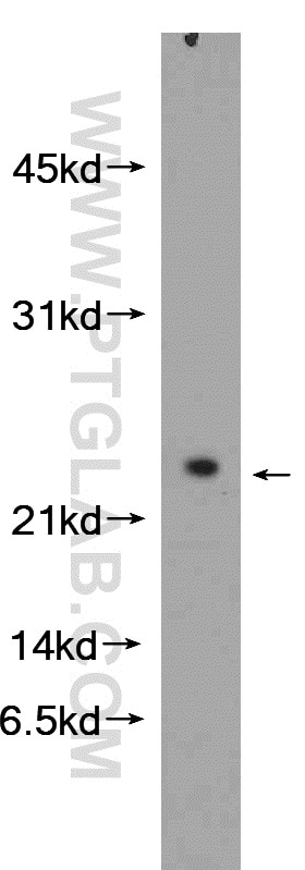 Western Blot (WB) analysis of mouse liver tissue using NDUFB10 Polyclonal antibody (15589-1-AP)