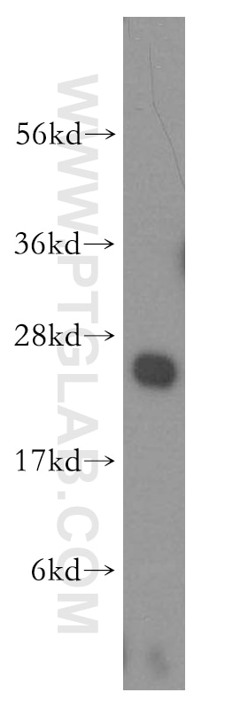 Western Blot (WB) analysis of human skeletal muscle tissue using NDUFB10 Polyclonal antibody (15589-1-AP)