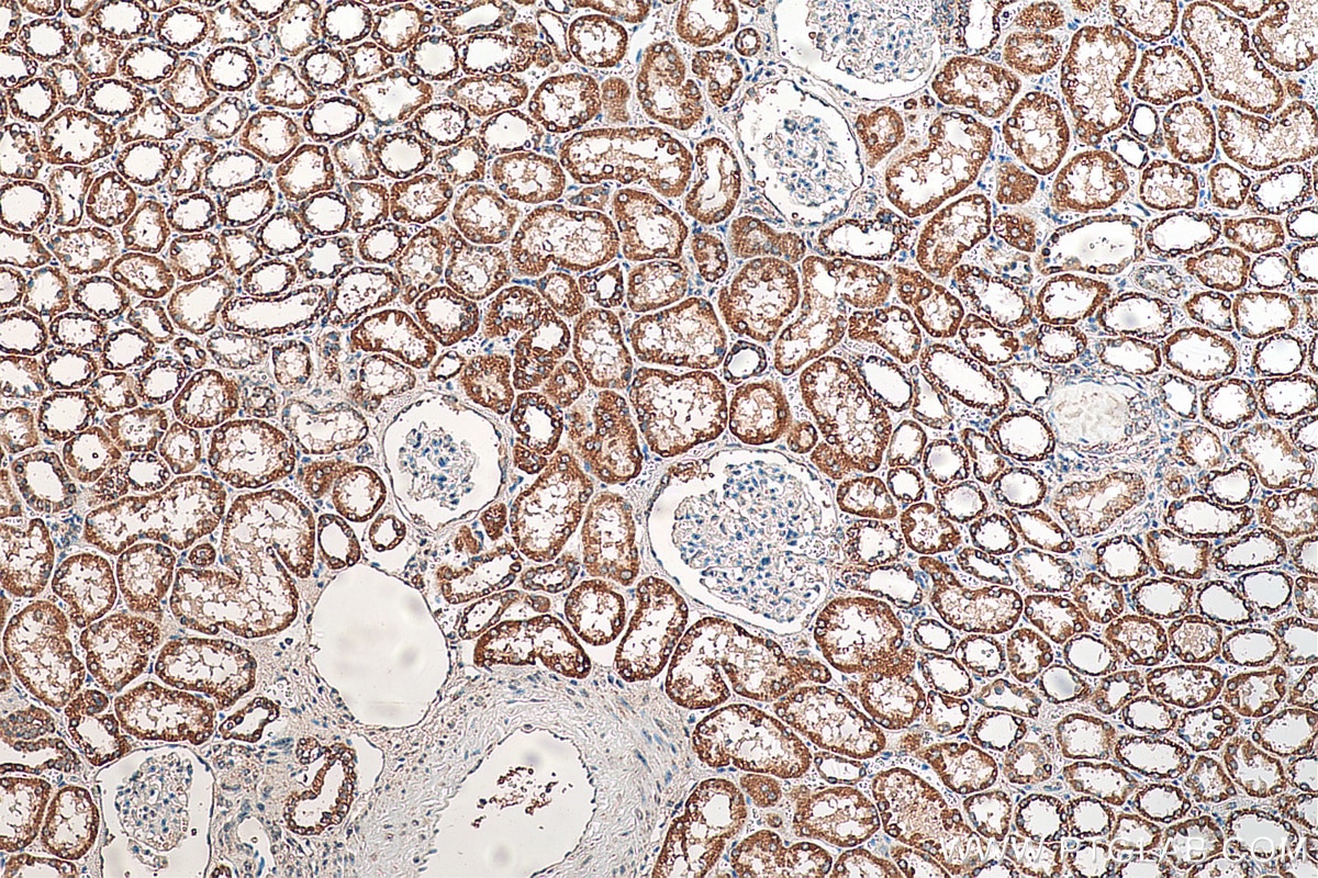 Immunohistochemistry (IHC) staining of human kidney tissue using NDUFB11 Polyclonal antibody (16720-1-AP)