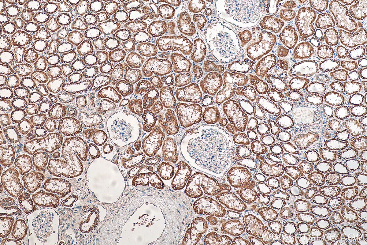 IHC staining of human kidney using 16720-1-AP