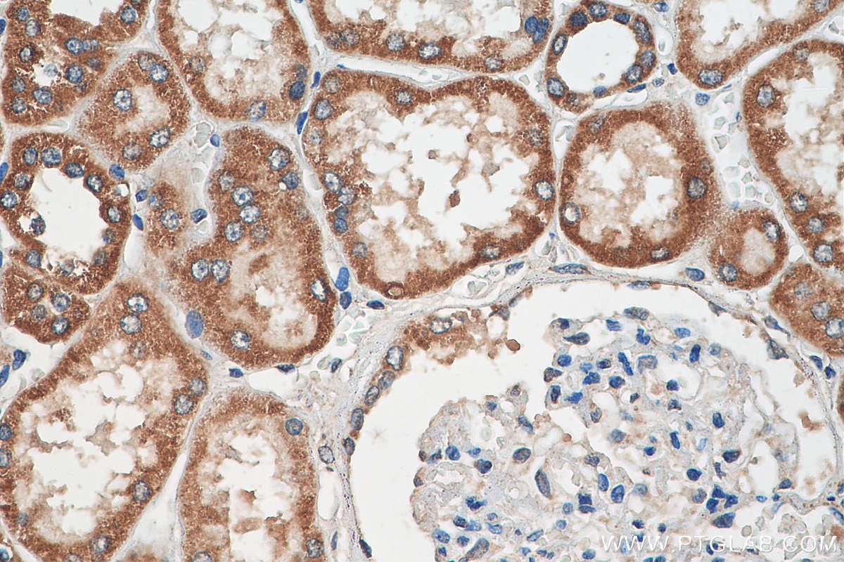 Immunohistochemistry (IHC) staining of human kidney tissue using NDUFB11 Polyclonal antibody (16720-1-AP)