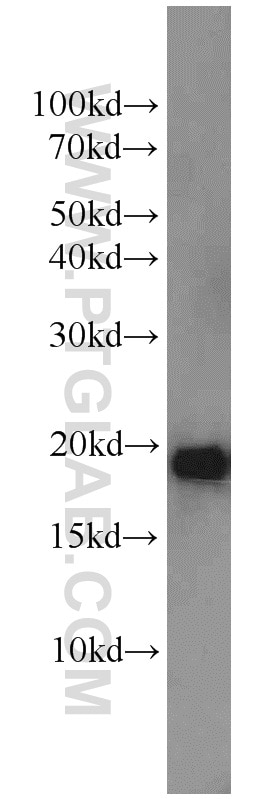 NDUFB11 Polyclonal antibody