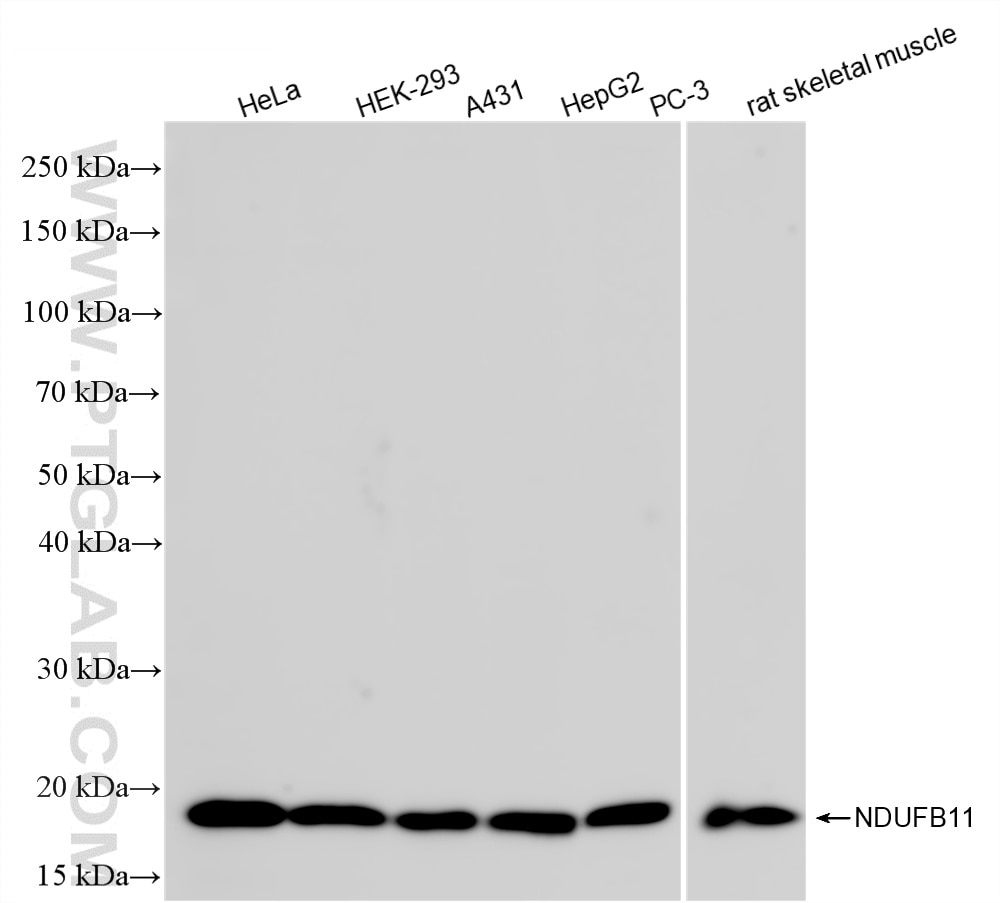 Various lysates were subjected to SDS PAGE followed by western blot with 87048-2-RR (NDUFB11 antibody) at dilution of 1:10000 incubated at room temperature for 1.5 hours. This data was developed using the same antibody clone with 87048-2-PBS in a different storage buffer formulation. Western Blot (WB) analysis of various lysates using NDUFB11 Recombinant monoclonal antibody (87048-2-RR)