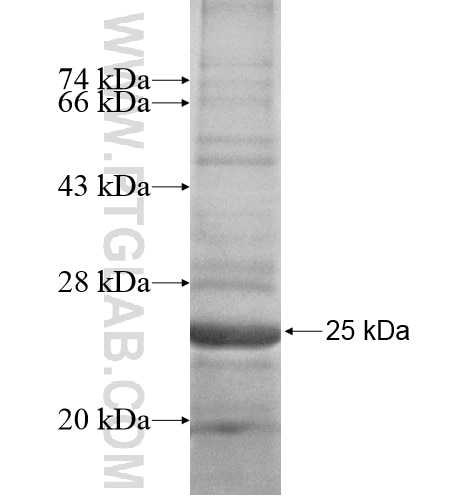 NDUFB11 fusion protein Ag10209 SDS-PAGE