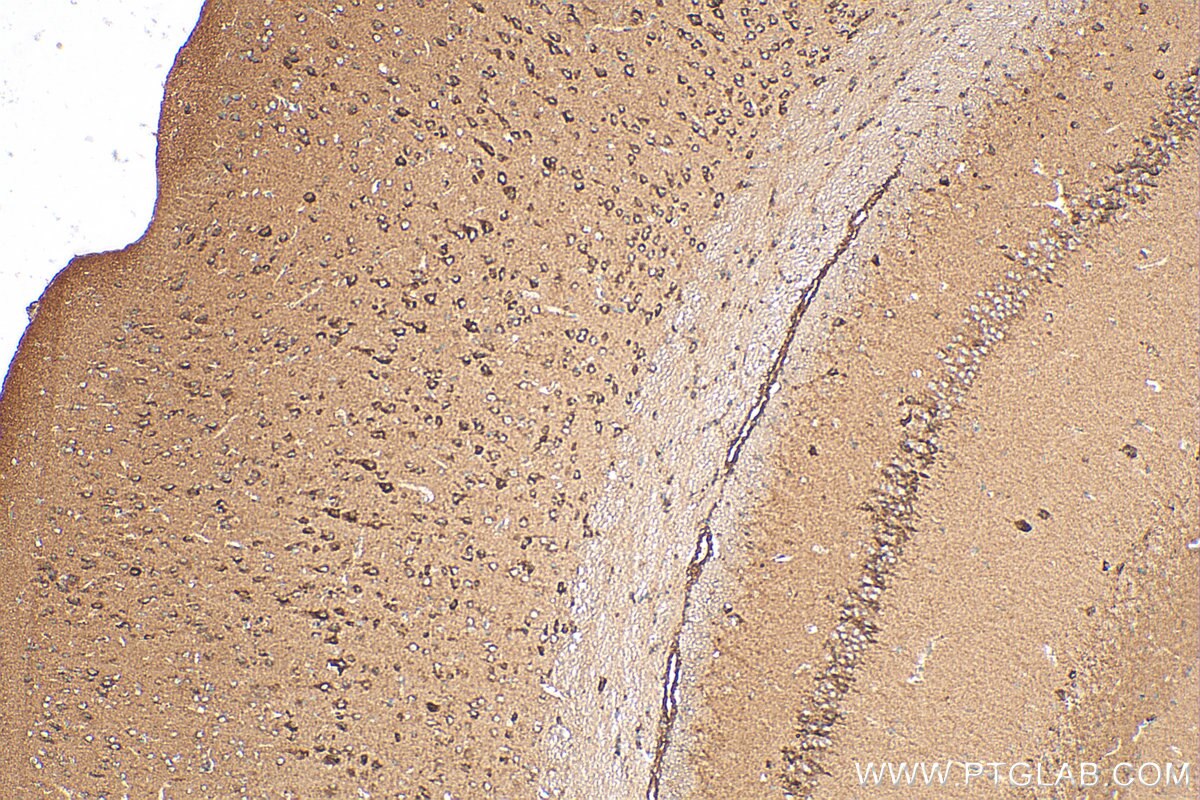 Immunohistochemistry (IHC) staining of mouse brain tissue using NDUFB2 Polyclonal antibody (17614-1-AP)