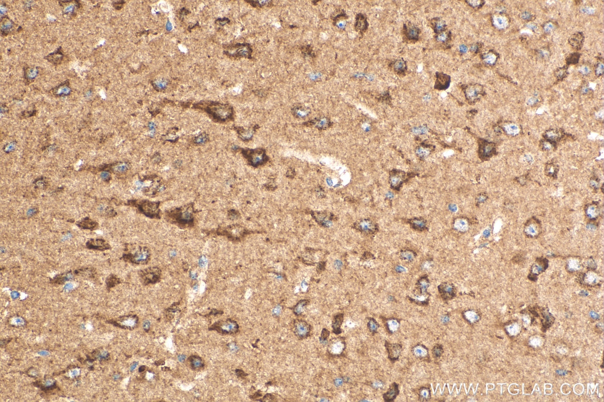 Immunohistochemistry (IHC) staining of mouse brain tissue using NDUFB2 Polyclonal antibody (17614-1-AP)