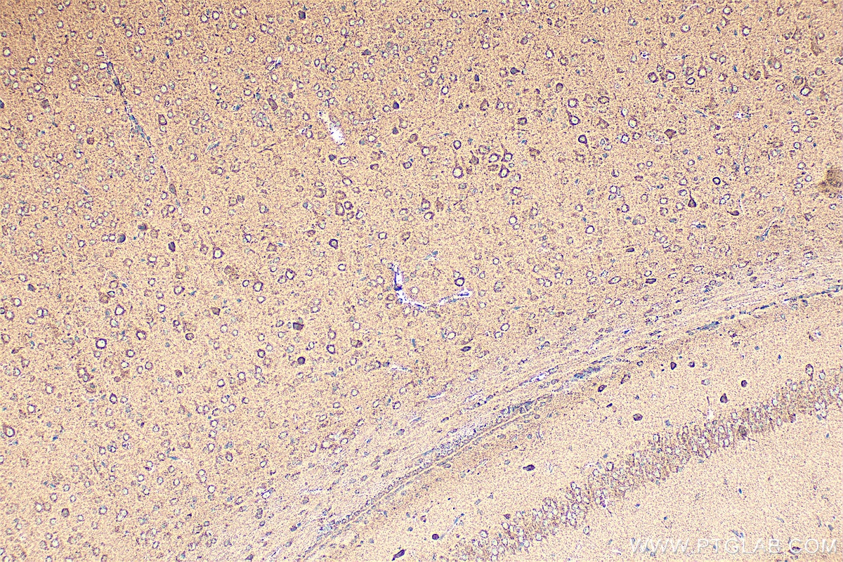 Immunohistochemistry (IHC) staining of mouse brain tissue using NDUFB2 Polyclonal antibody (17614-1-AP)