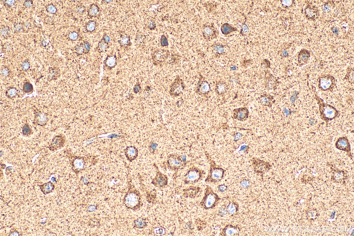 Immunohistochemistry (IHC) staining of mouse brain tissue using NDUFB2 Polyclonal antibody (17614-1-AP)