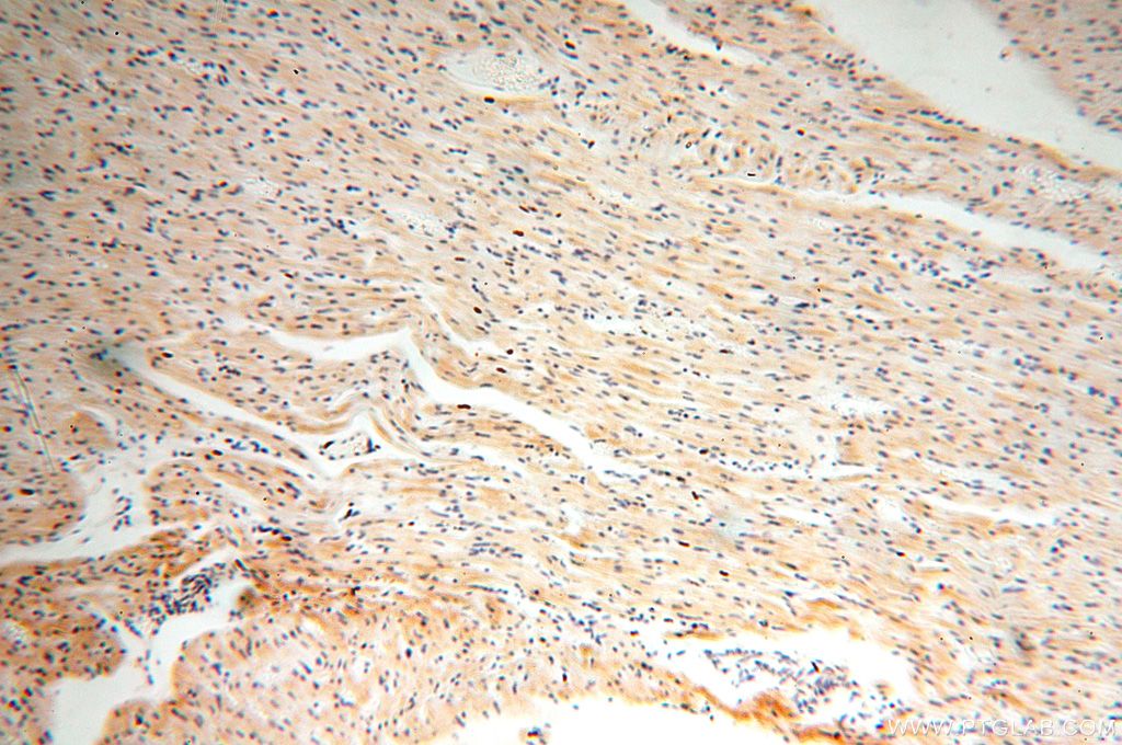 IHC staining of human heart using 17614-1-AP