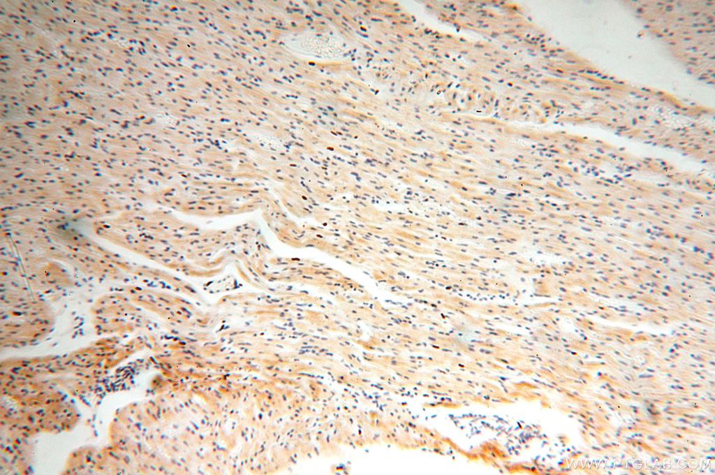 Immunohistochemistry (IHC) staining of human heart tissue using NDUFB2 Polyclonal antibody (17614-1-AP)