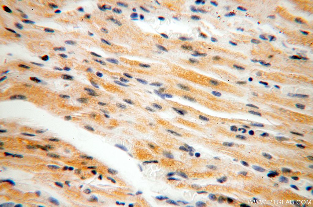 Immunohistochemistry (IHC) staining of human heart tissue using NDUFB2 Polyclonal antibody (17614-1-AP)