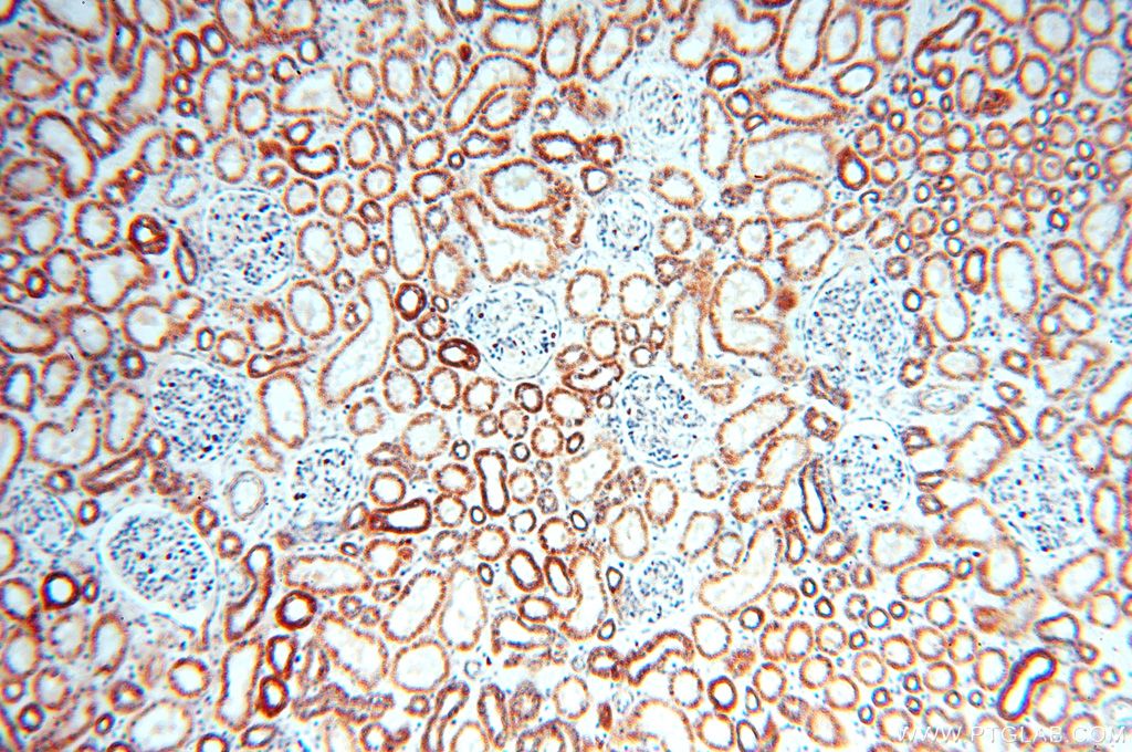 Immunohistochemistry (IHC) staining of human kidney tissue using NDUFB2 Polyclonal antibody (17614-1-AP)