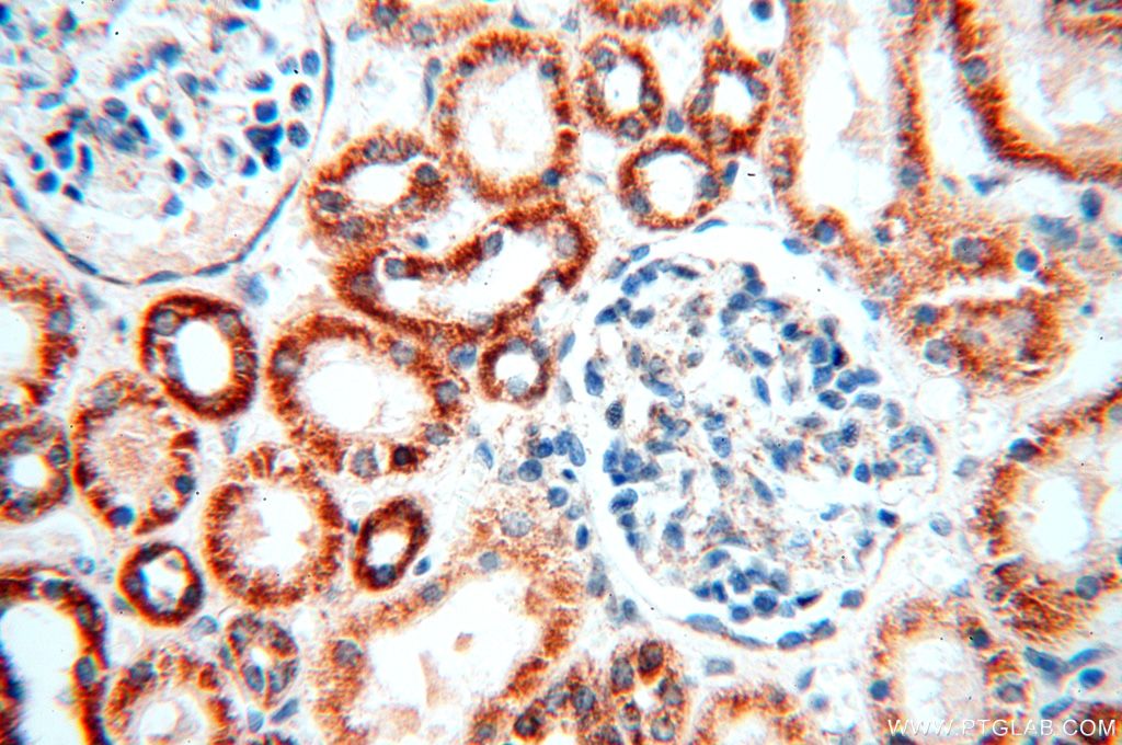 Immunohistochemistry (IHC) staining of human kidney tissue using NDUFB2 Polyclonal antibody (17614-1-AP)