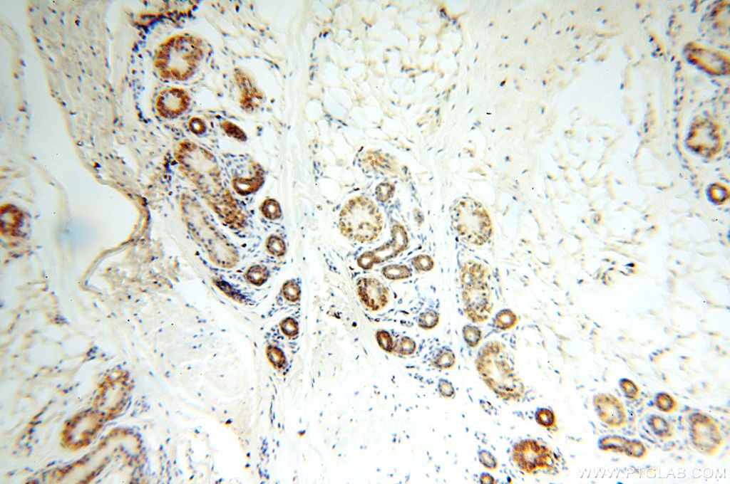 Immunohistochemistry (IHC) staining of human skin tissue using NDUFB2 Polyclonal antibody (17614-1-AP)