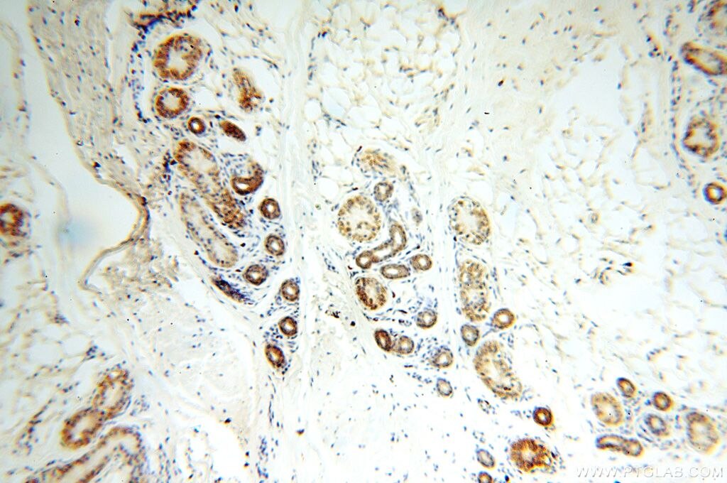 IHC staining of human skin using 17614-1-AP