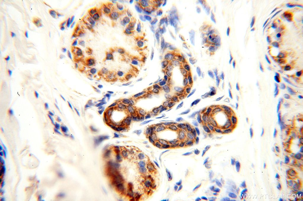 Immunohistochemistry (IHC) staining of human skin tissue using NDUFB2 Polyclonal antibody (17614-1-AP)