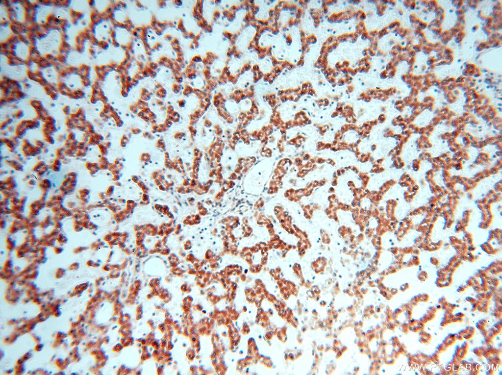 IHC staining of human liver using 17614-1-AP
