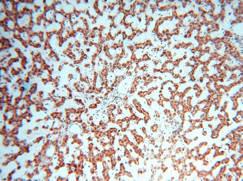 Immunohistochemistry (IHC) staining of human liver tissue using NDUFB2 Polyclonal antibody (17614-1-AP)