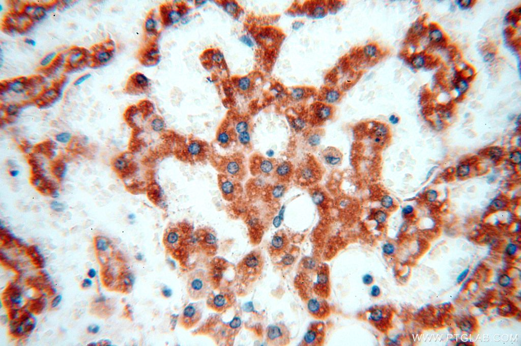 Immunohistochemistry (IHC) staining of human liver tissue using NDUFB2 Polyclonal antibody (17614-1-AP)