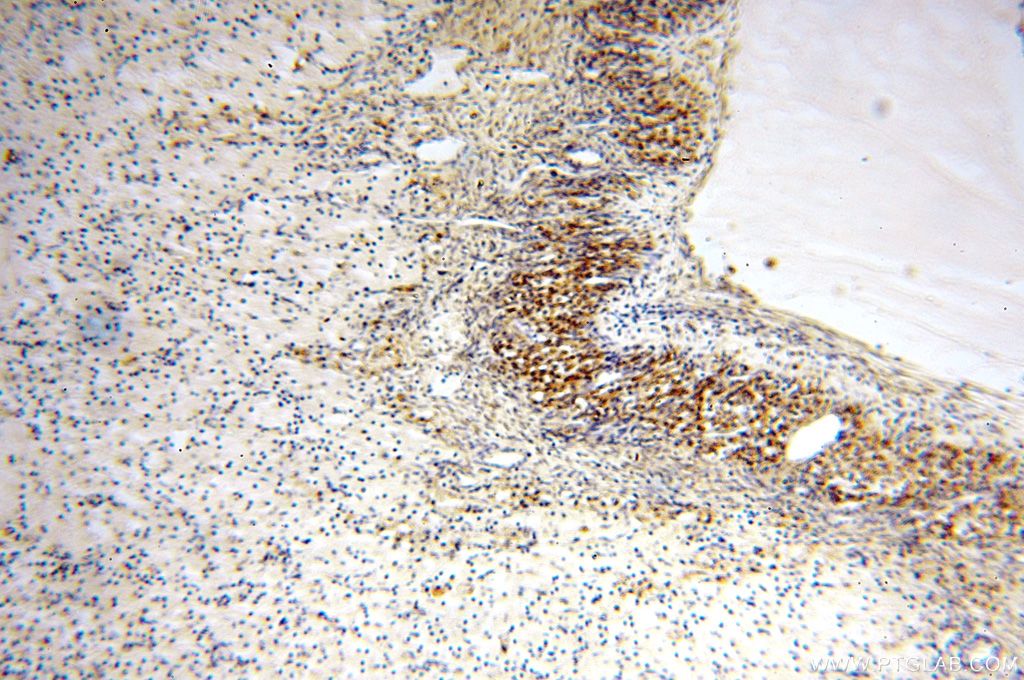 Immunohistochemistry (IHC) staining of human ovary tissue using NDUFB2 Polyclonal antibody (17614-1-AP)