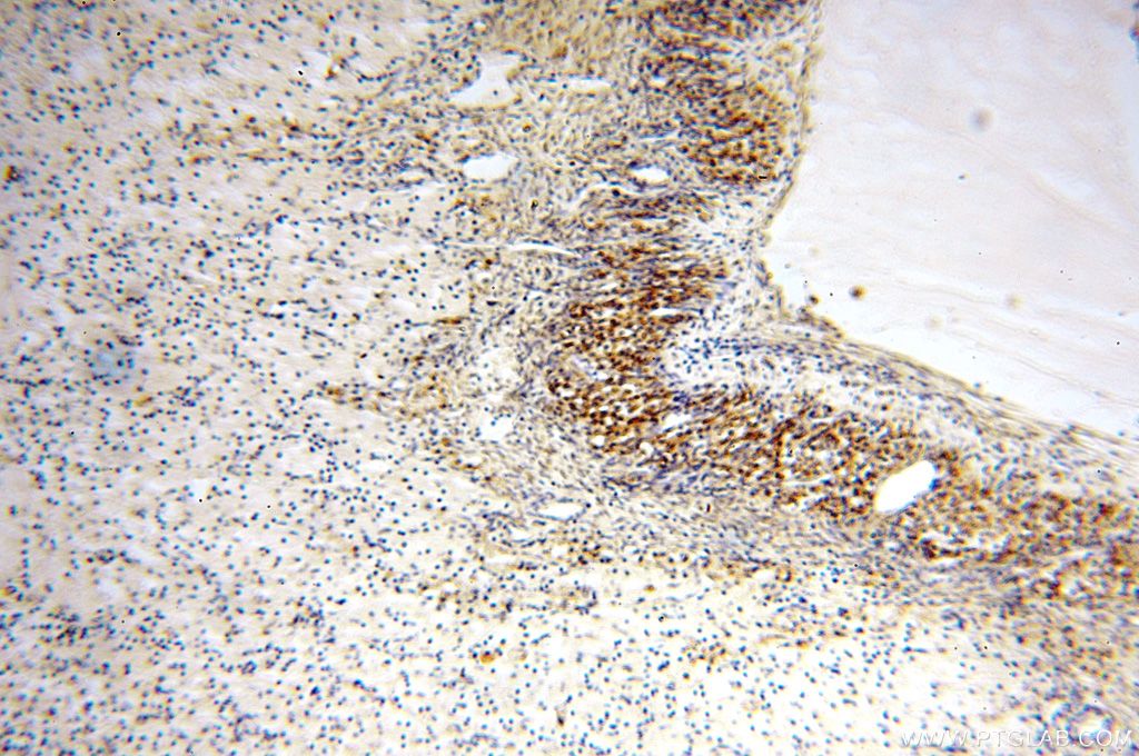 IHC staining of human ovary using 17614-1-AP