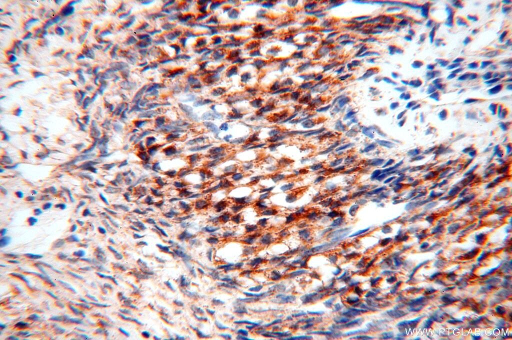 Immunohistochemistry (IHC) staining of human ovary tissue using NDUFB2 Polyclonal antibody (17614-1-AP)