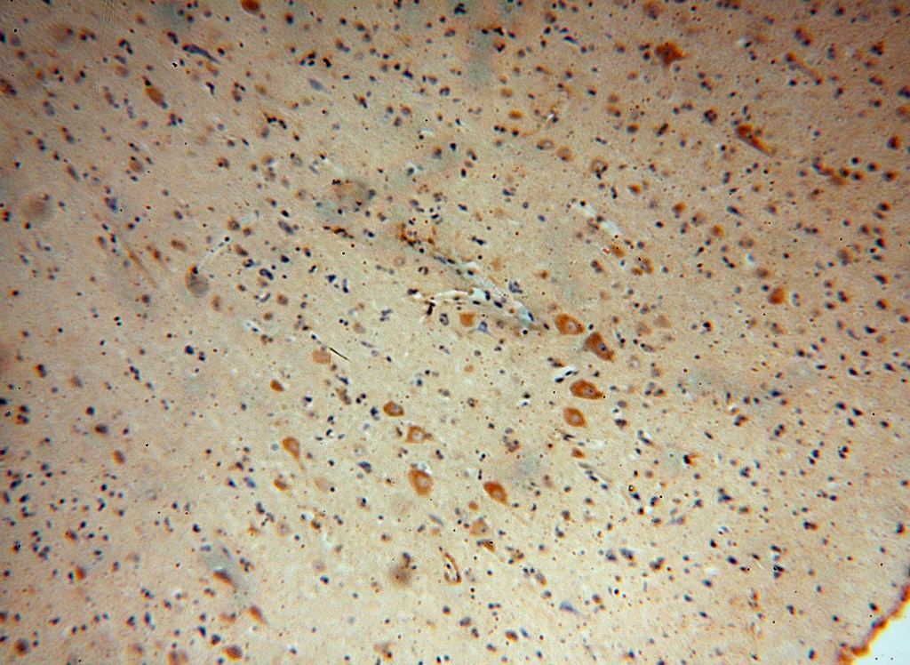 IHC staining of human brain using 17614-1-AP
