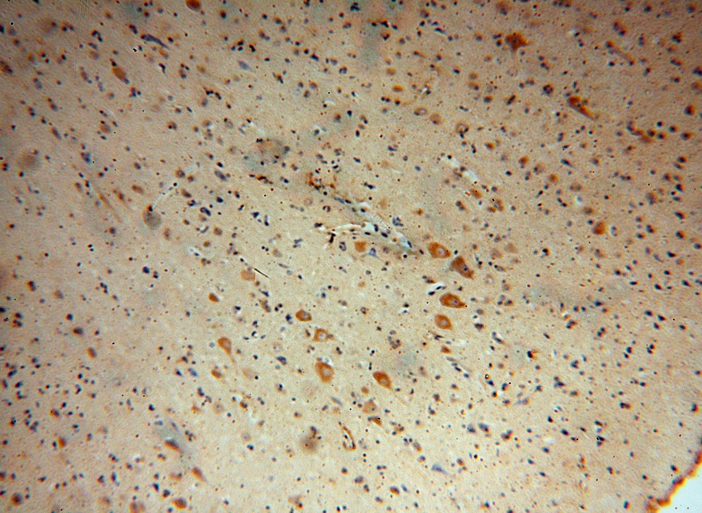 Immunohistochemistry (IHC) staining of human brain tissue using NDUFB2 Polyclonal antibody (17614-1-AP)