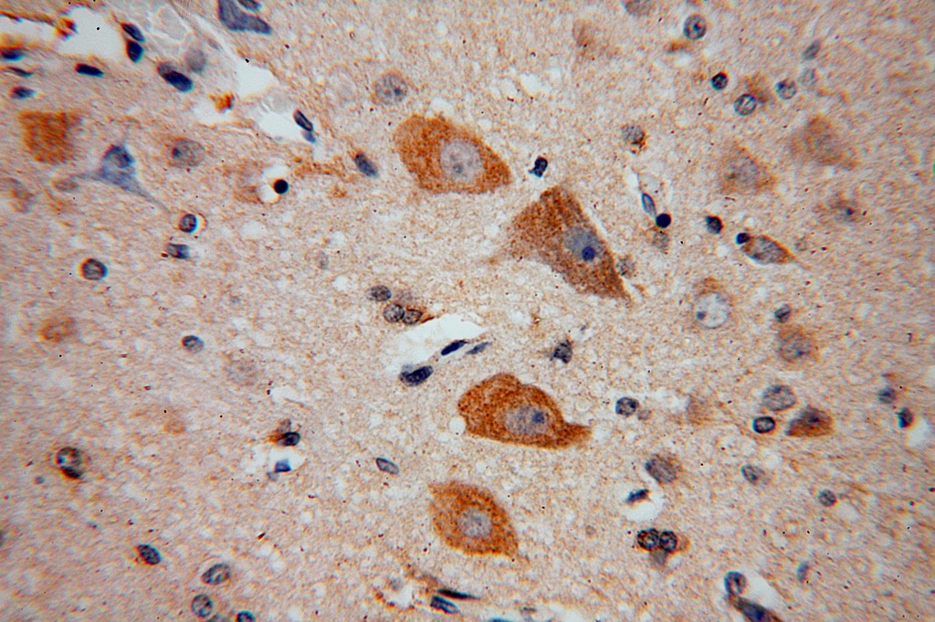 Immunohistochemistry (IHC) staining of human brain tissue using NDUFB2 Polyclonal antibody (17614-1-AP)