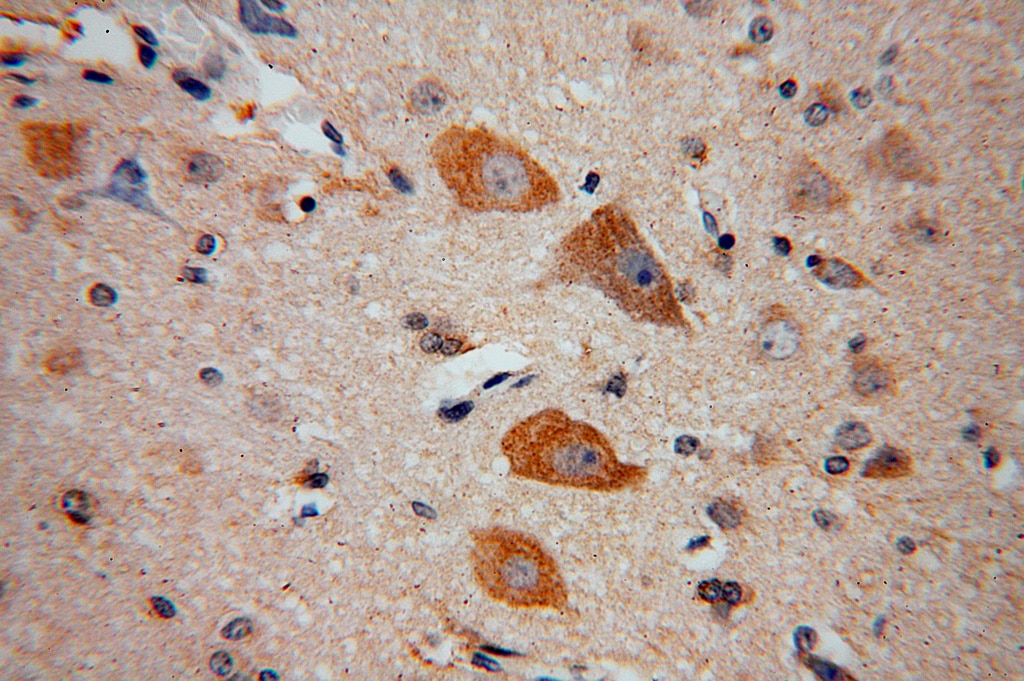 IHC staining of human brain using 17614-1-AP