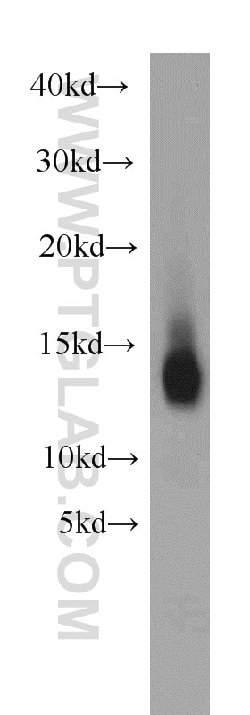 Western Blot (WB) analysis of human heart tissue using NDUFB2 Polyclonal antibody (17614-1-AP)