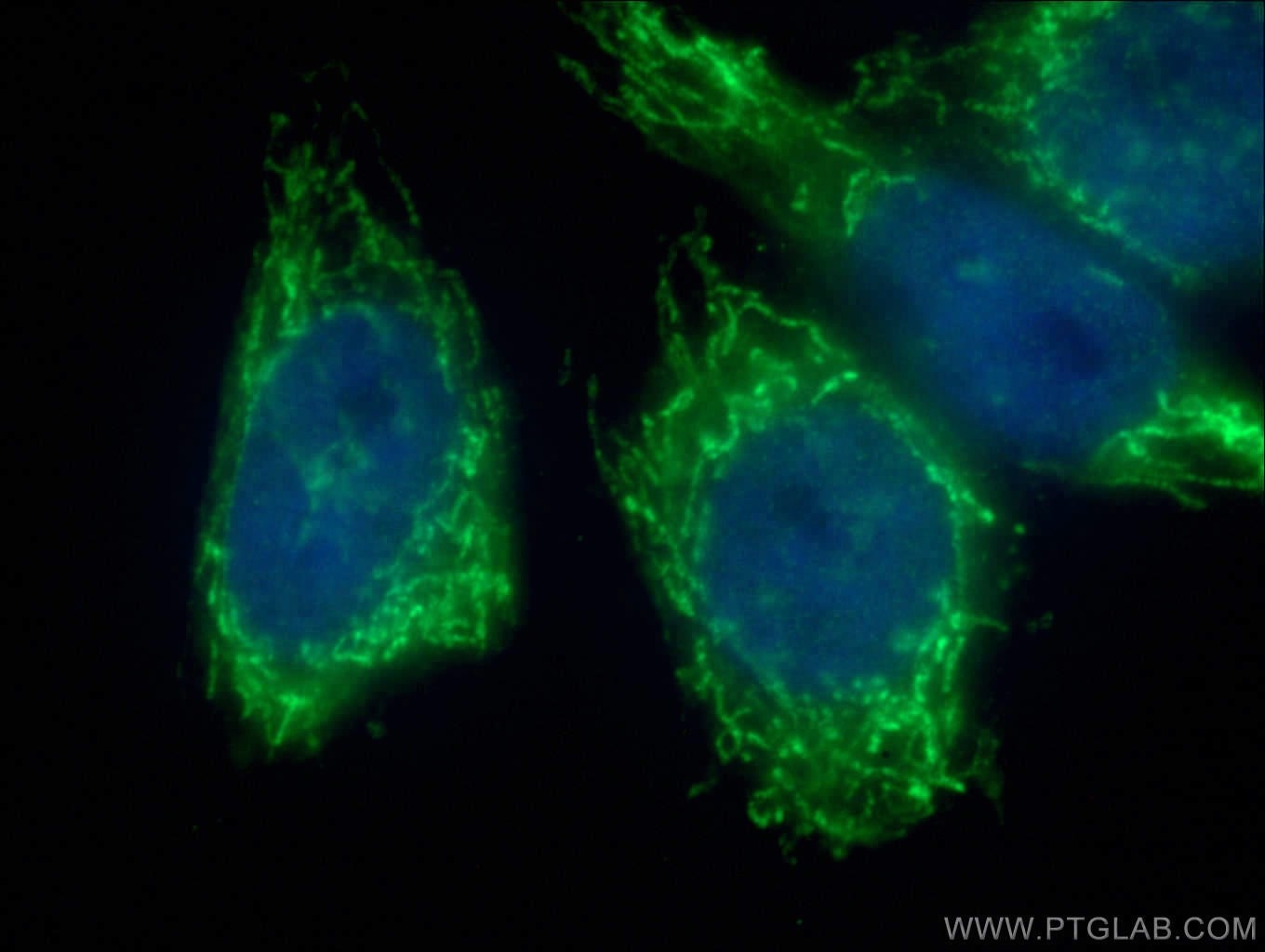 Immunofluorescence (IF) / fluorescent staining of HeLa cells using NDUFB4 Polyclonal antibody (27931-1-AP)