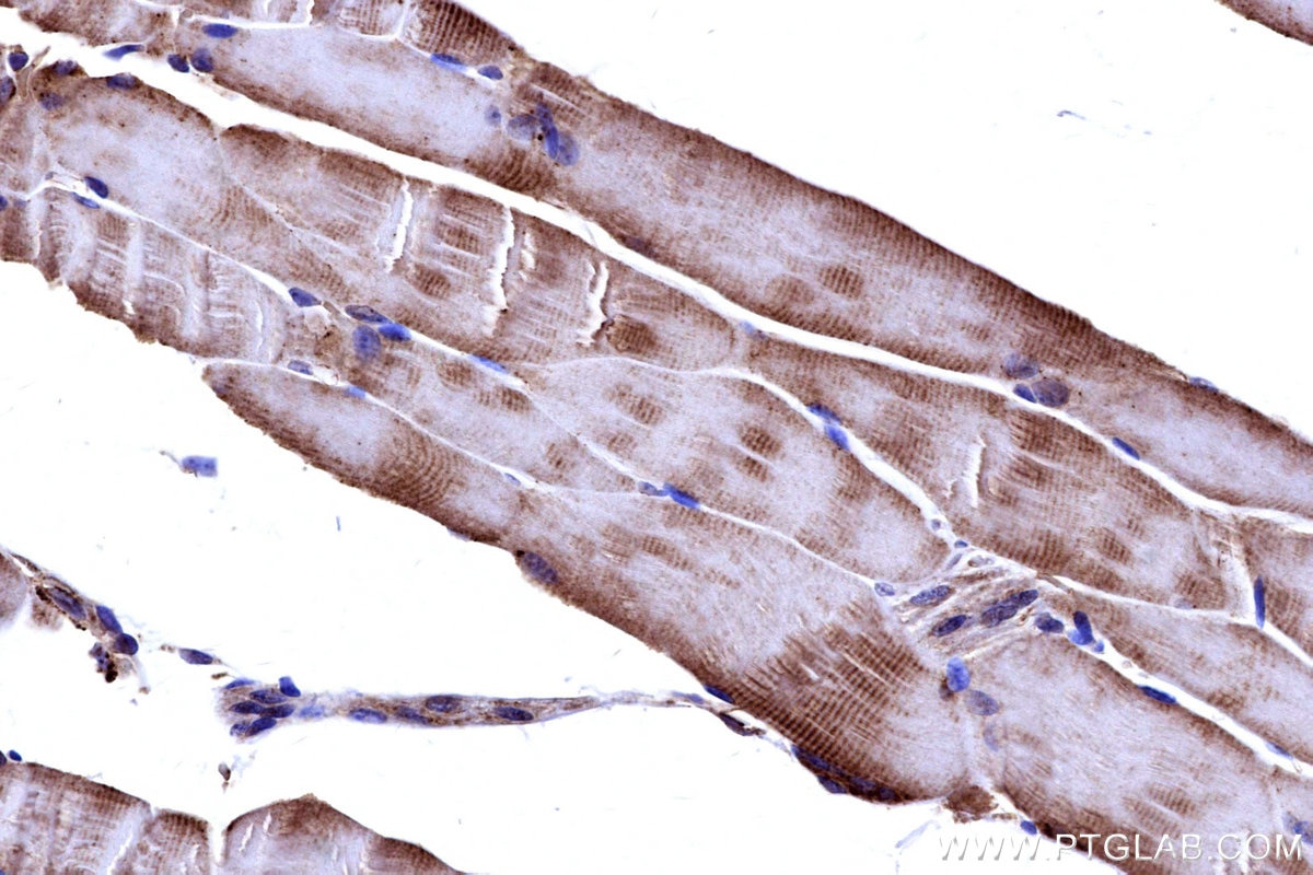 IHC staining of mouse skeletal muscle using 27931-1-AP Immunohistochemistry (IHC) staining of mouse skeletal muscle tissue using NDUFB4 Polyclonal antibody (27931-1-AP)
