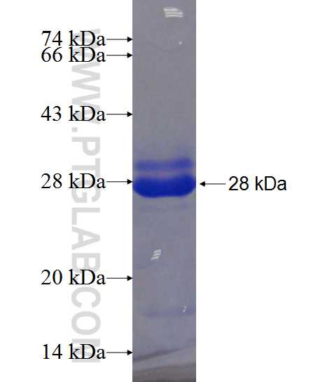 NDUFB5 fusion protein Ag20907 SDS-PAGE