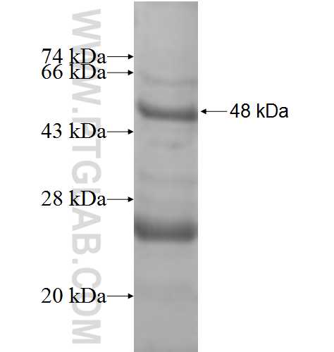 NDUFB5 fusion protein Ag8634 SDS-PAGE NDUFB5 fusion protein Ag8634 SDS-PAGE