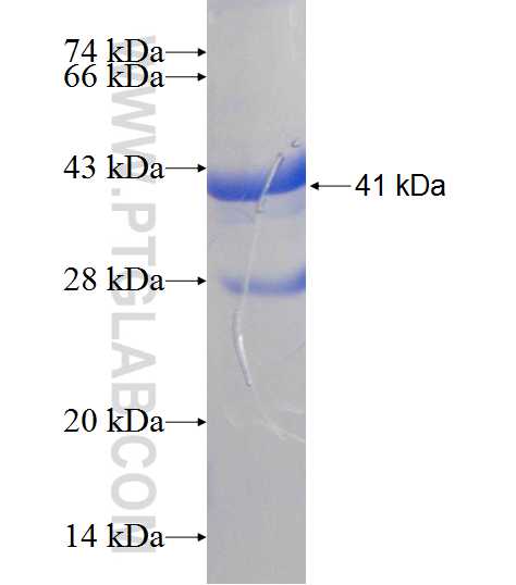 NDUFB6 fusion protein Ag8908 SDS-PAGE