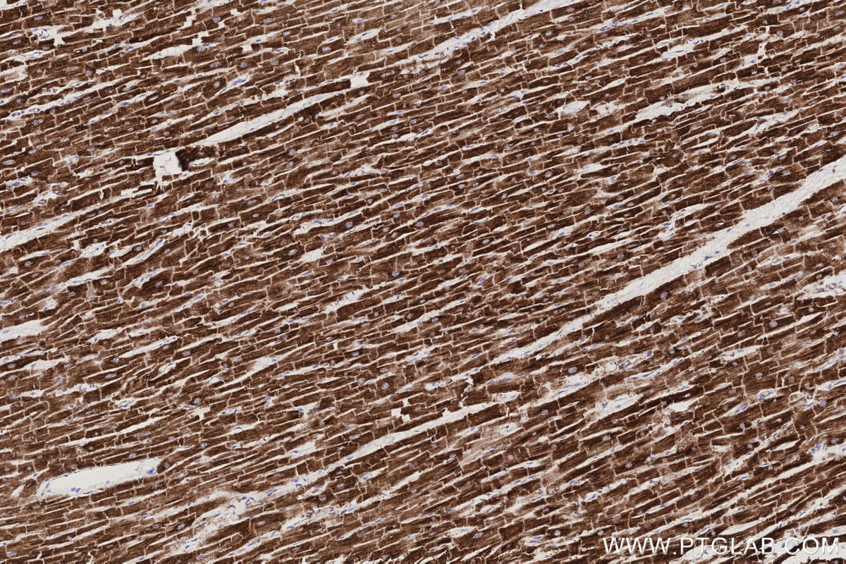 Immunohistochemistry (IHC) staining of human heart tissue using NDUFB7 Polyclonal antibody (14912-1-AP)