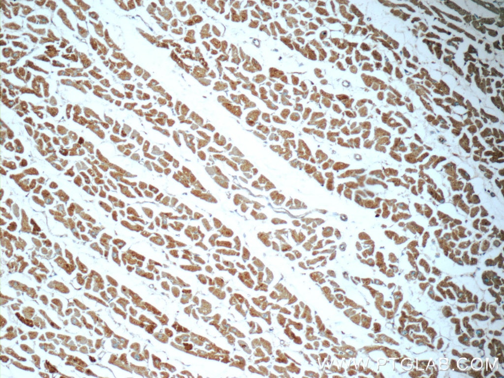 Immunohistochemistry (IHC) staining of human heart tissue using NDUFB7 Polyclonal antibody (14912-1-AP)