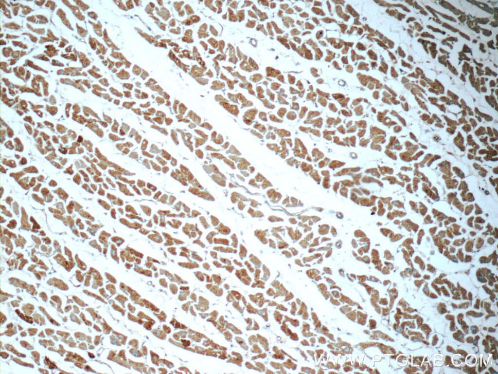 IHC staining of human heart using 14912-1-AP