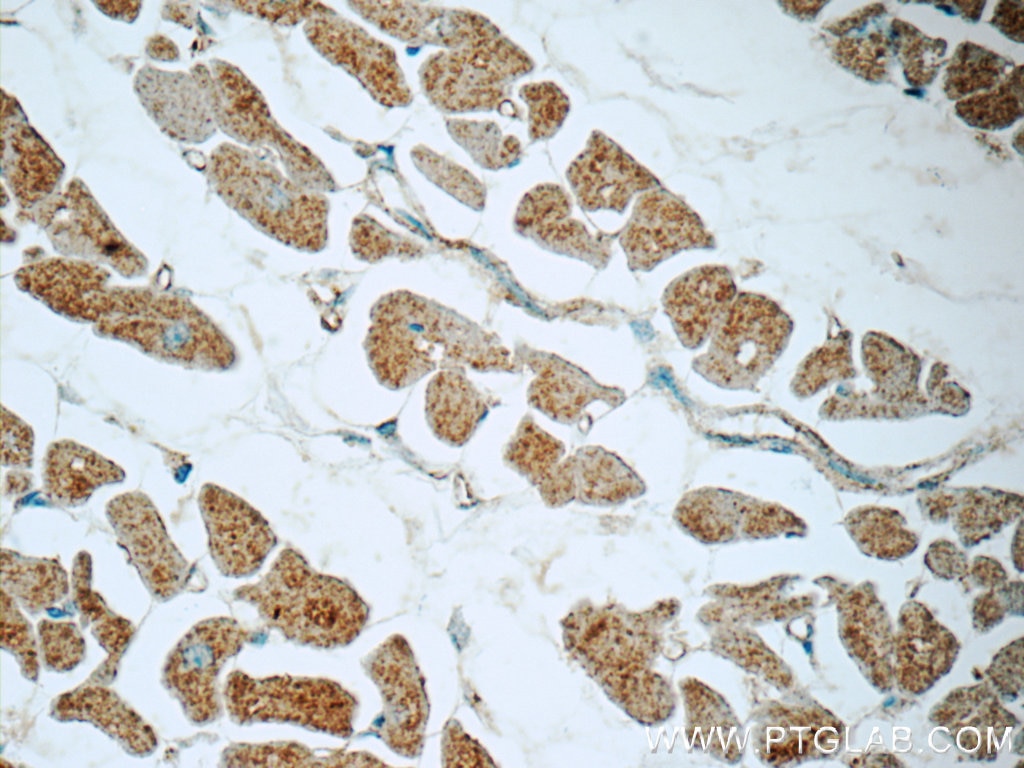 Immunohistochemistry (IHC) staining of human heart tissue using NDUFB7 Polyclonal antibody (14912-1-AP)