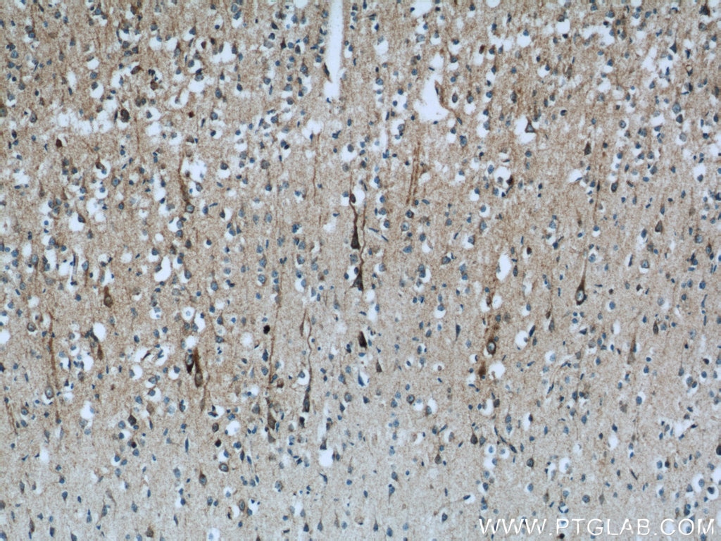 Immunohistochemistry (IHC) staining of human brain tissue using NDUFB7 Polyclonal antibody (14912-1-AP)