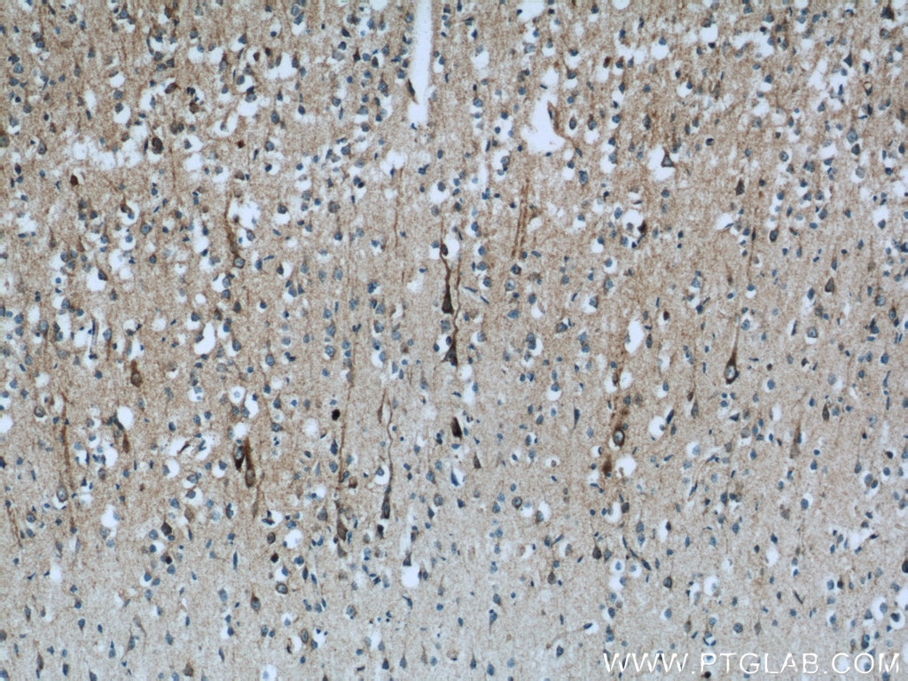 IHC staining of human brain using 14912-1-AP