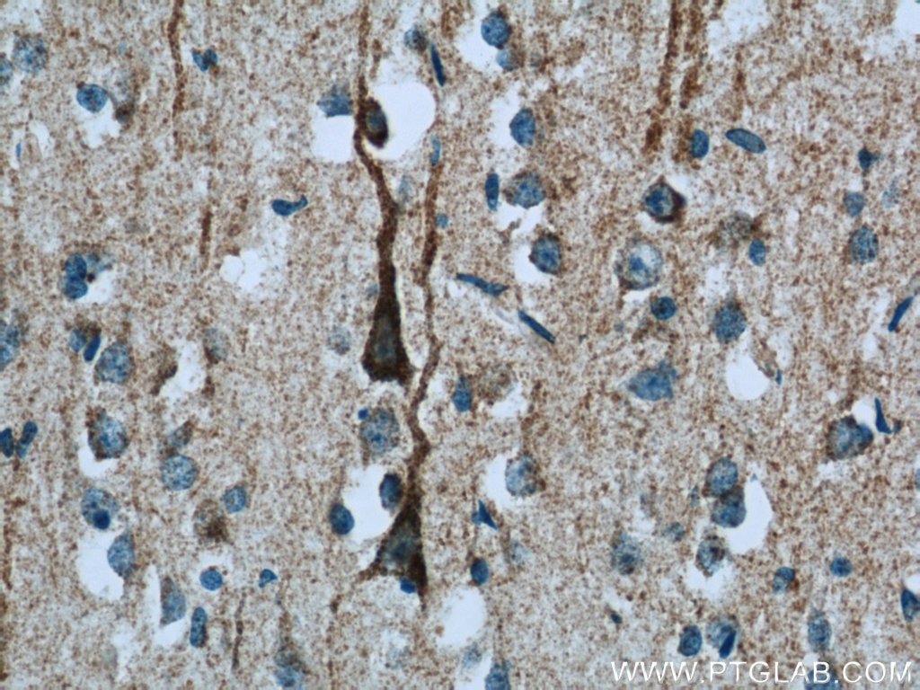 Immunohistochemistry (IHC) staining of human brain tissue using NDUFB7 Polyclonal antibody (14912-1-AP)